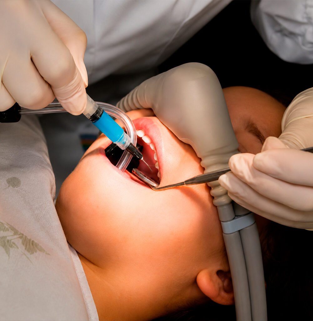 sedação-consciente-óxido-nitroso-atendimento-odontológico-conforto-do-paciente-procedimento-odontológico-dentista-saúde-bucal-anestesia-consciente