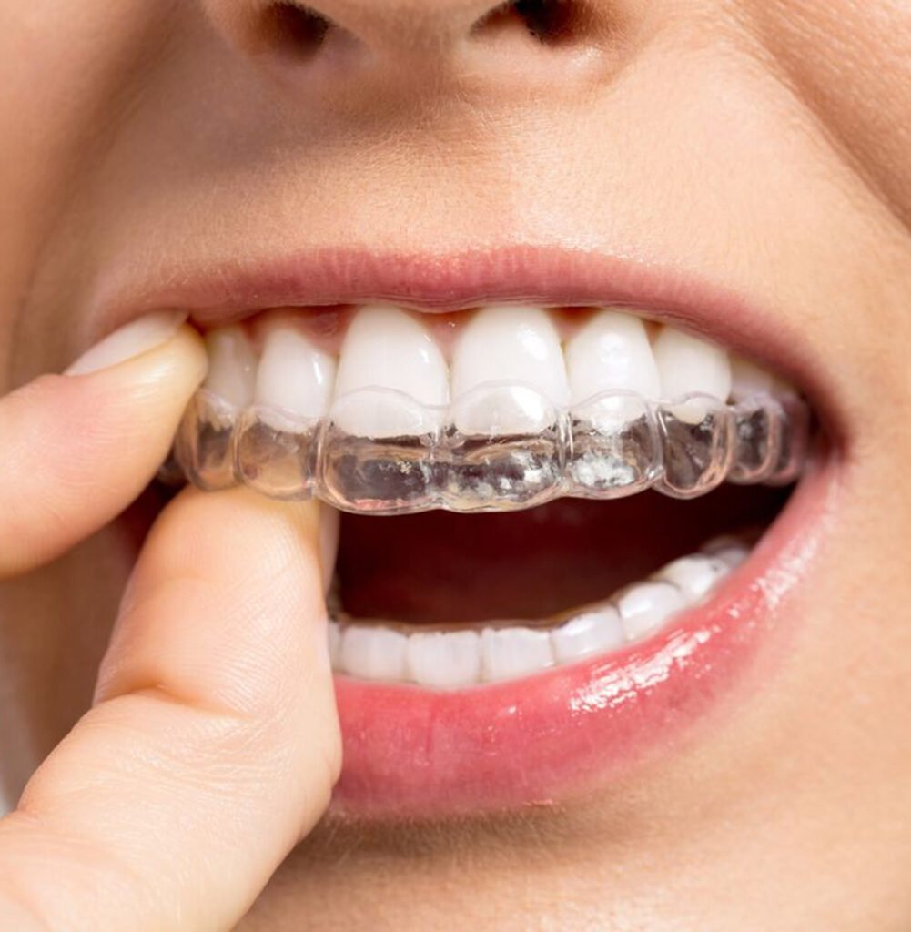 alinhadores-invisíveis-ortodontia-estética-alinhador-transparente-tratamento-ortodôntico-correção-do-sorriso-saúde-bucal-ortodontia-digital
